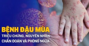 Nguyên nhân gây bệnh đậu mùa