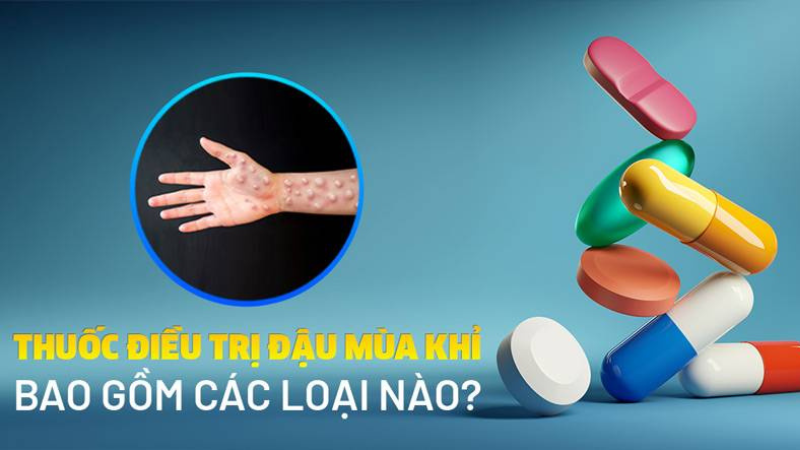 cách chữa bệnh đậu mùa khỉ